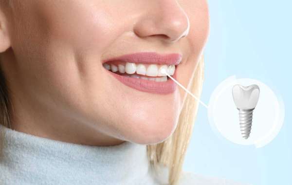 Local Experts in Dental Implants and Invisalign